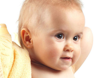 婴幼儿湿疹治疗 警惕4个误区